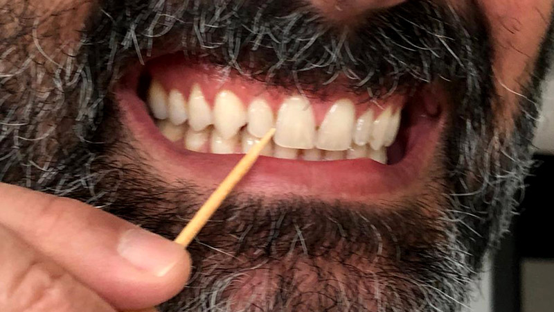 PALITOS DE DENTES